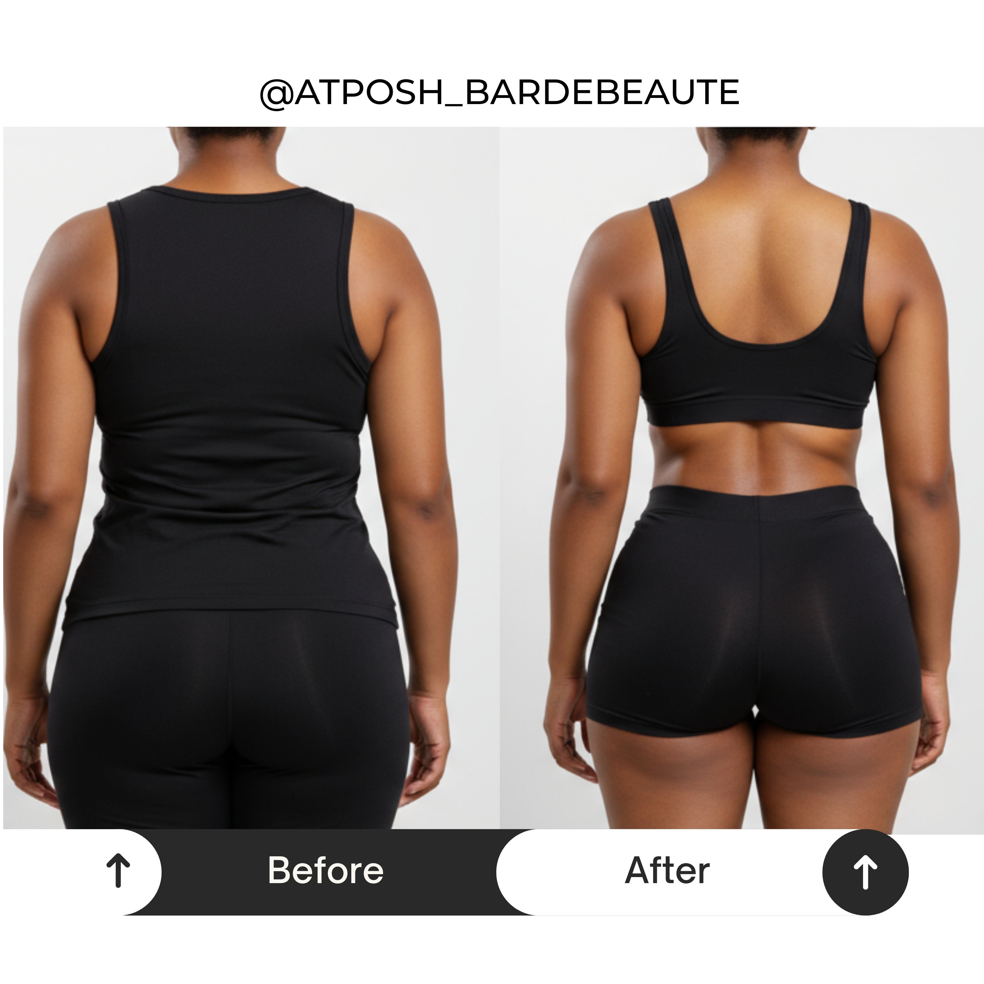 Body Contouring